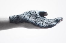 MHOX and CRP Technology turned to 3D printing and an additive material process to manufacture a next generation of orthosis